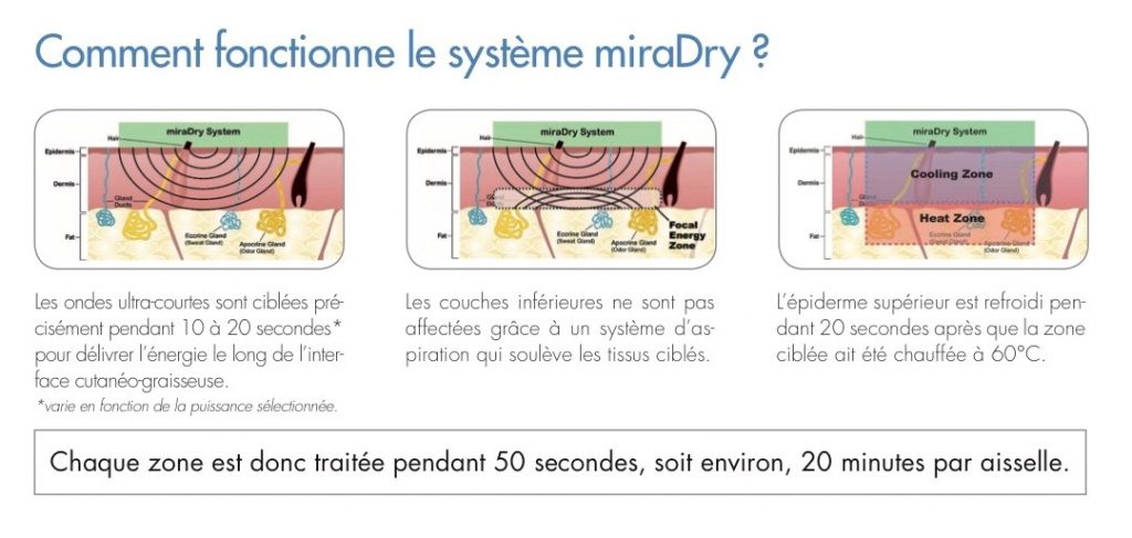 Fonctionnement du traitement miraDry